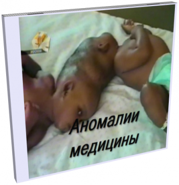 Аномалии медицины (4 Серии) / Medical Mysteries